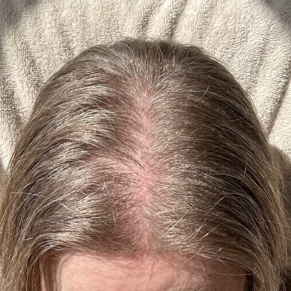 Declare Independence From Shedding.