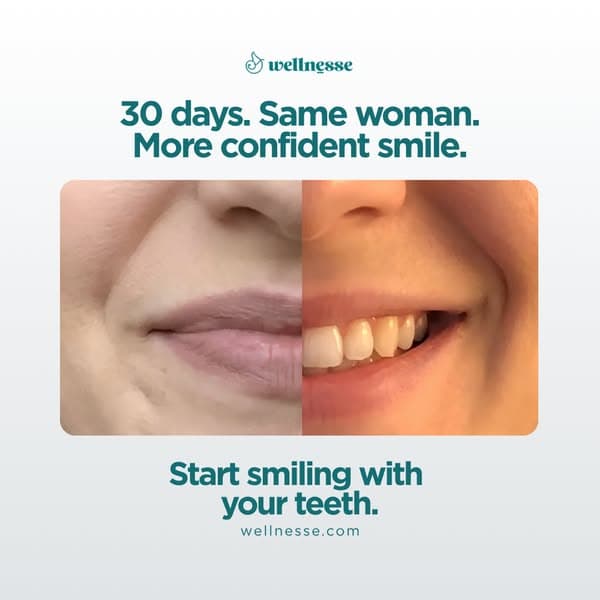 Heal Your Teeth + Save $87