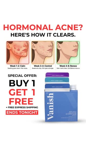 Hear their acne story...