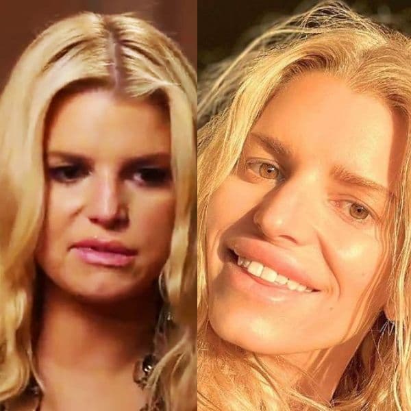 IA. removemos a cirurgia plástica dessas celebridades e ficamos surpresos: Cher poderia ser a melhor sem ela. Agora parece muito diferente. Há mais aqui, incluindo Demi Moore, Michael Jackson e Donatella Versace.