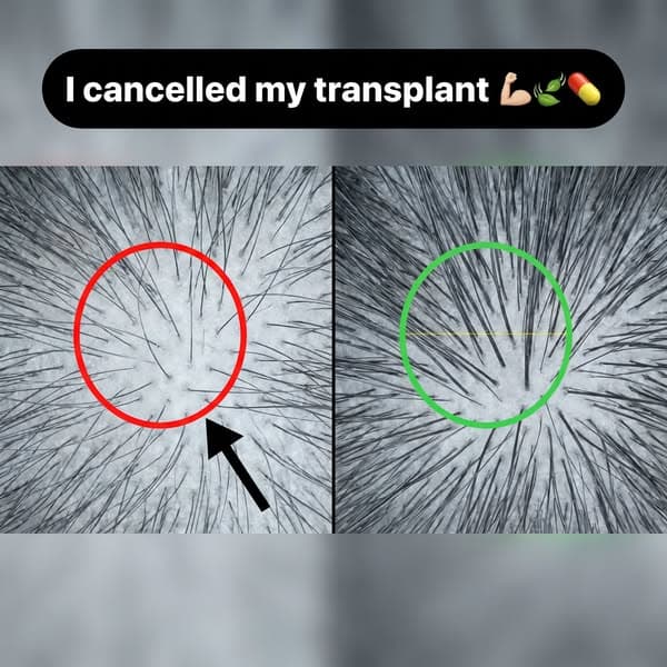 Doc said "it's just menopause", she was WRONG.