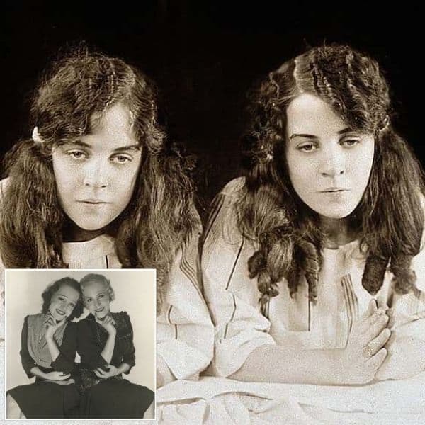 A perturbadora história real de Daisy e Violet Hilton: gêmeas siamesas enfrentam uma luta ao longo da vida.
