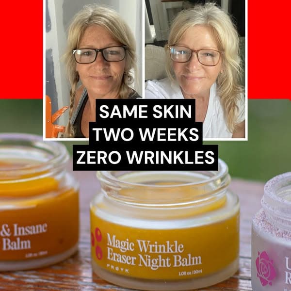 Retinol thins your skin [Try the real fix]