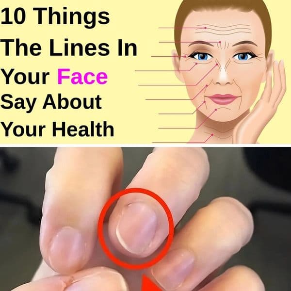 Recognize These Symptoms❓ Seek Help From A Doctor