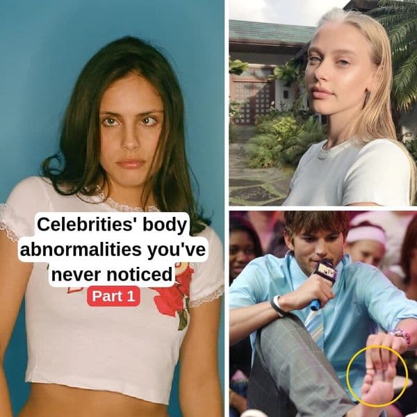 35+ Stars With Beautifully Unique Genetic Features