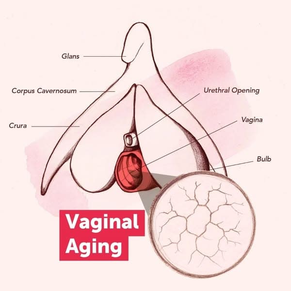 Men Get Medicine Women Get Menopause