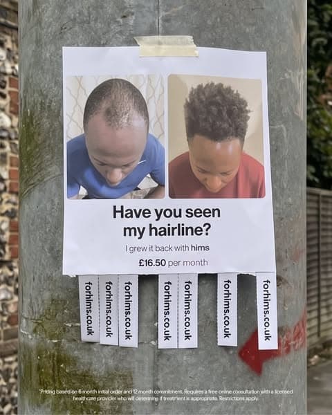 Take control of your hair loss today!