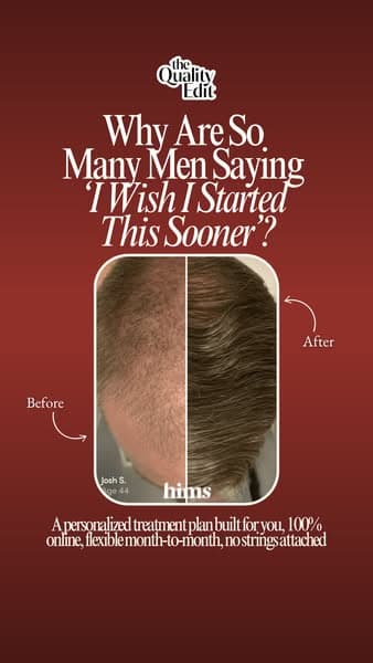 Personalized Hair Loss Treatment, Built for You