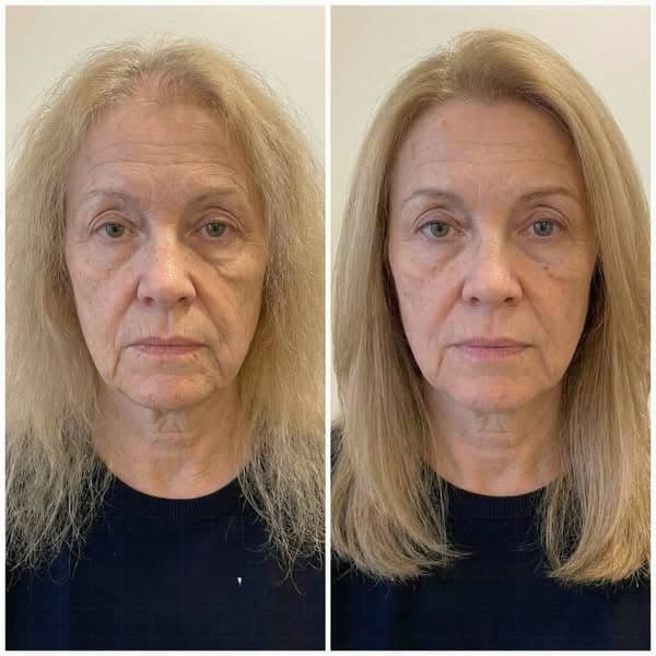 Doc said “it’s just menopause.” She was WRONG.