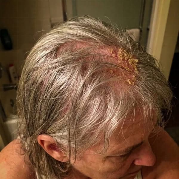 Doc said "it's just menopause". She was WRONG.