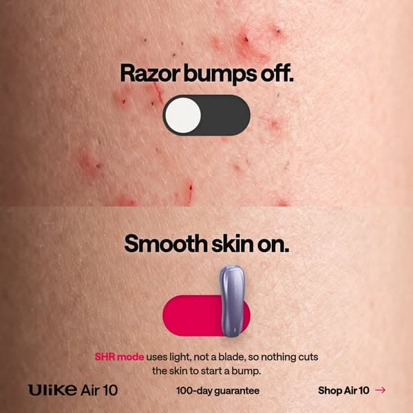 Say Goodbye to Hair - Shop Ulike Air10’s Fast & Painless Hair Removal Now!