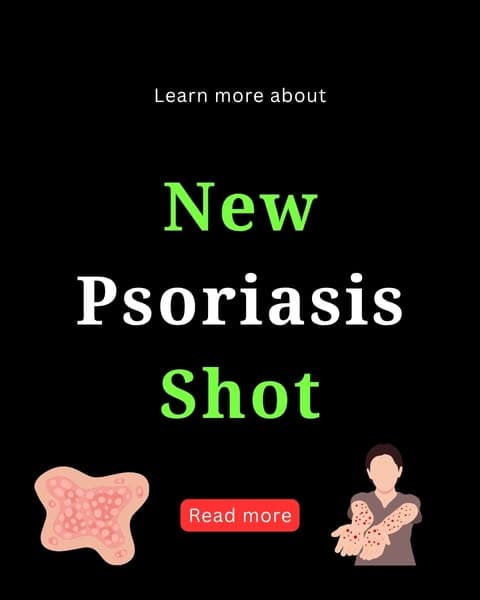 Learn About Psoriasis Treatment Developments