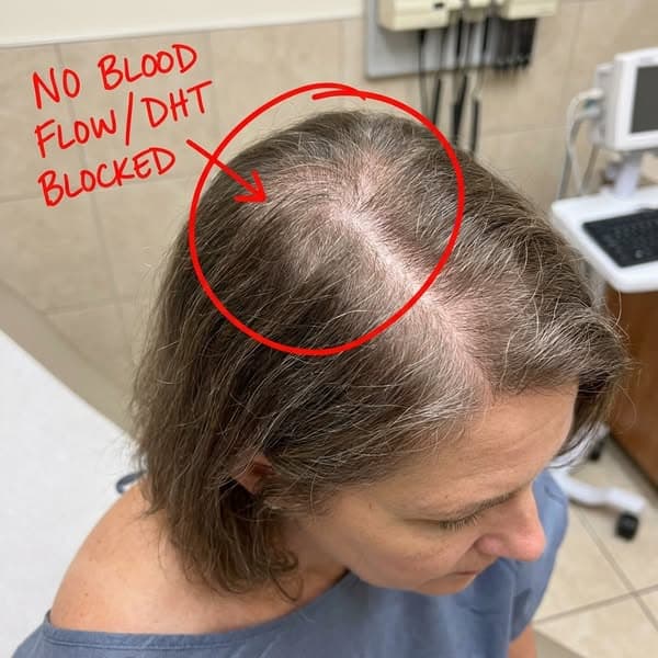 Doc said "it's just menopause." She was WRONG.
