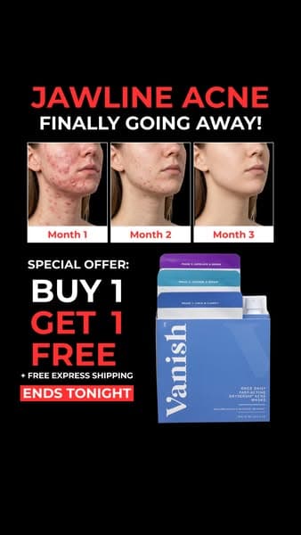 Hear their acne story...