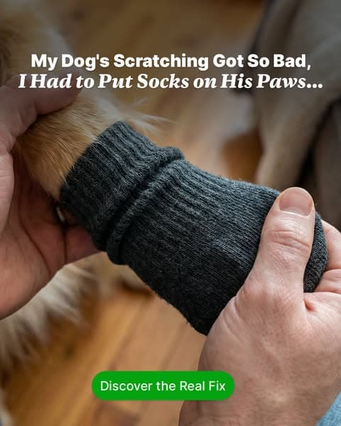 Socks Don’t Stop Why They Itch.