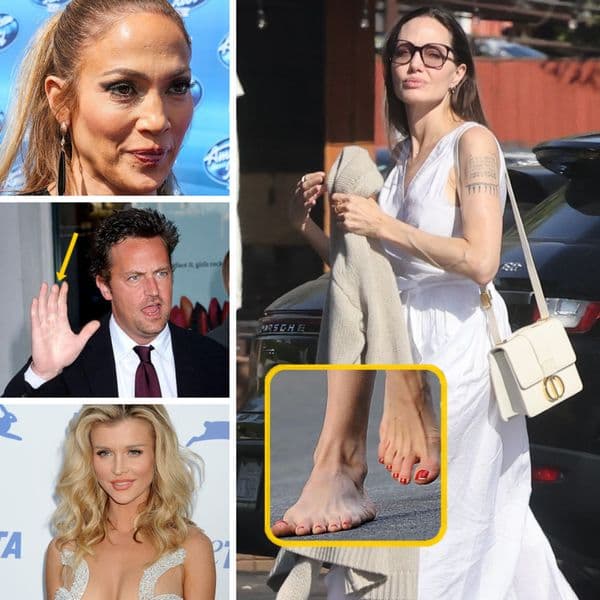 36+ Celebrità Con Rari Tratti Fisici