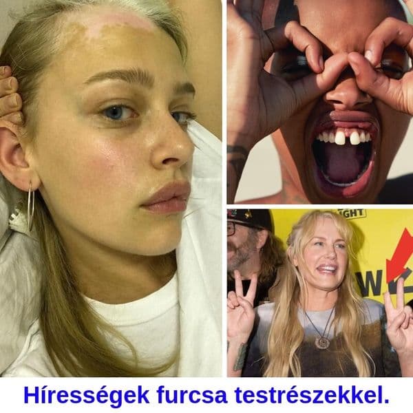 Több, mint 35 sztár, aki büszkék különleges testi adottságaikra.