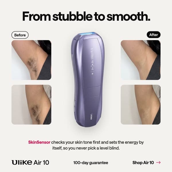 Say Goodbye to Hair - Shop Ulike Air10’s Fast & Painless Hair Removal Now!