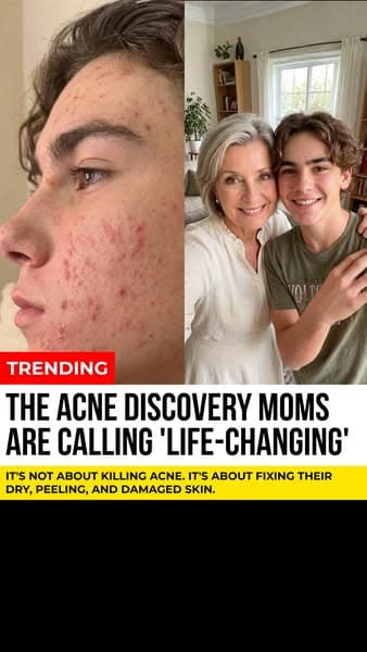 10 Seconds/Day To Clear Skin