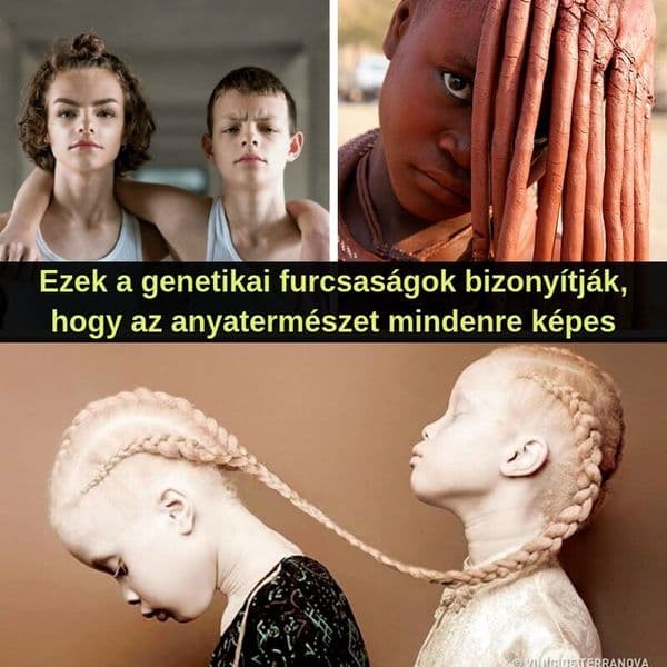 36+ Genetikai mutáció, amelyek komoly egyedi tulajdonságokat okoztak