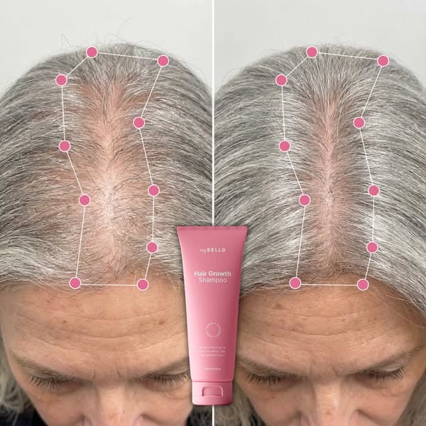 Discover The 8-Second Scalp Test That Predicts Hair Loss.