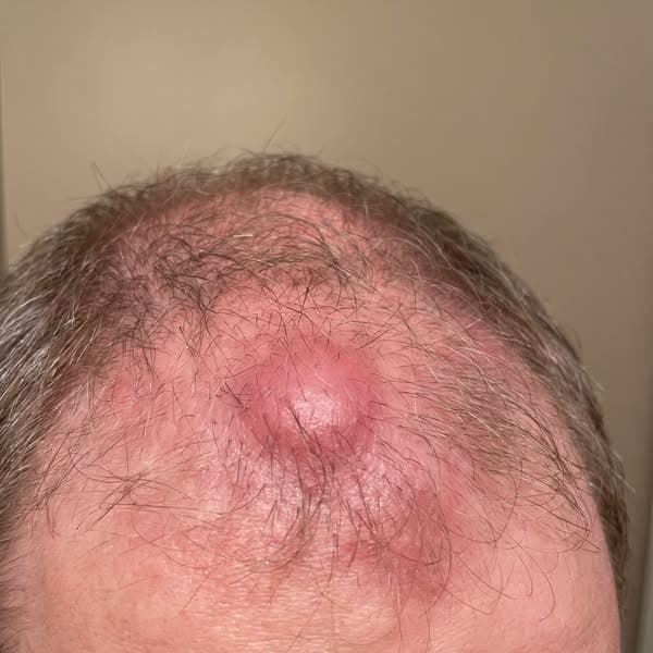 Doc said “it’s just menopause.” She was WRONG.