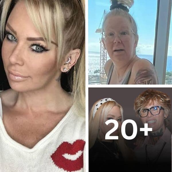Famous People Living with Chronic Conditions