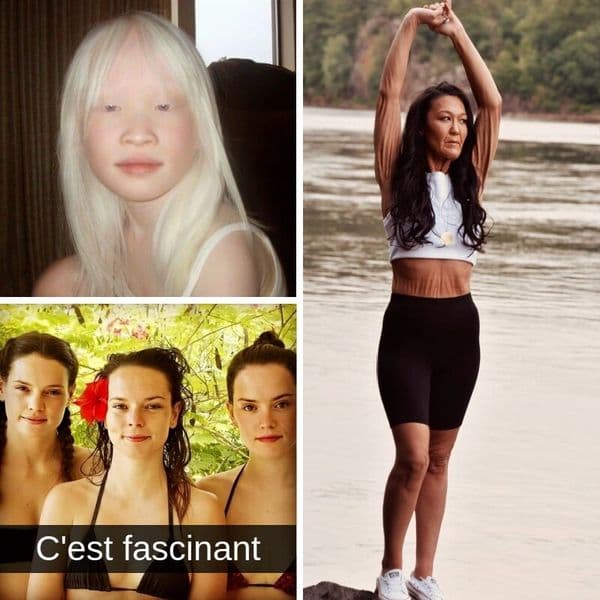 À Quel Point Nos Traits Génétiques Sont-ils Rares❓il S'avère Qu'ils Le Sont Énormément