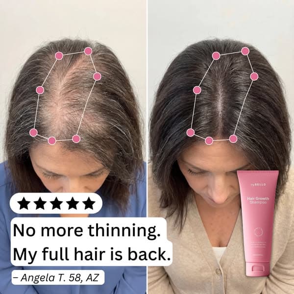 Discover The 8-Second Scalp Test That Predicts Hair Loss.