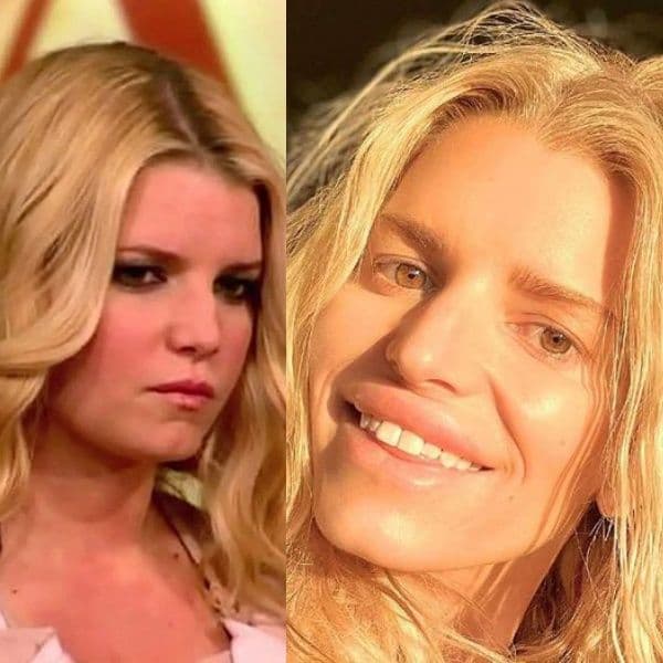 IA. a supprimé la chirurgie plastique de ces célébrités et nous avons été stupéfaits : Cher pourrait être le meilleur sans cela. Maintenant, c'est très différent. Il y en a d'autres ici, dont Demi Moore, Michael Jackson et Donatella...