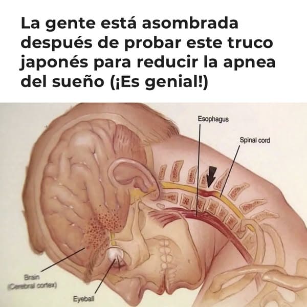 70% DE DESCUENTO solo por tiempo limitado 👉