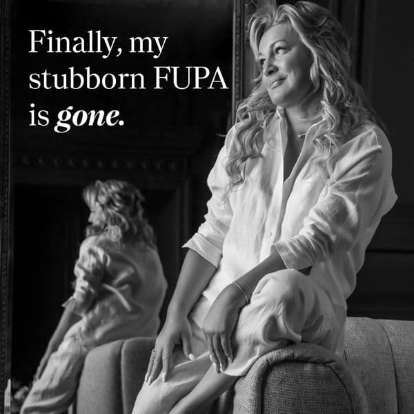 Bye-Bye FUPA, I never liked you anyway