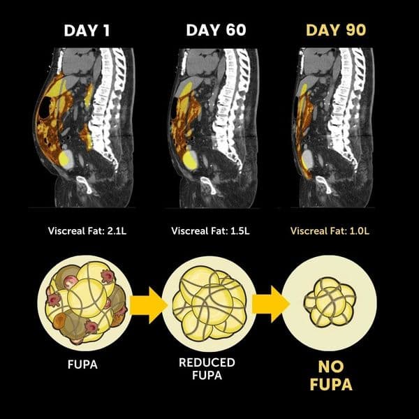 So this is why I go so fat so quick...