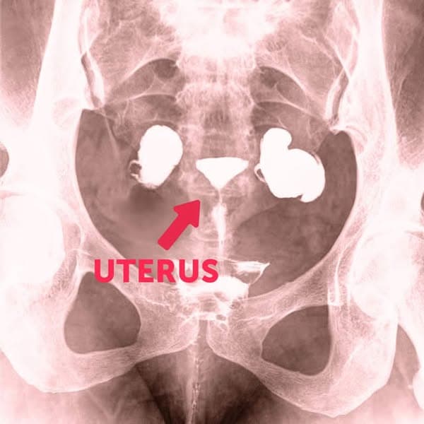 Men Get Medicine Women Get Menopause