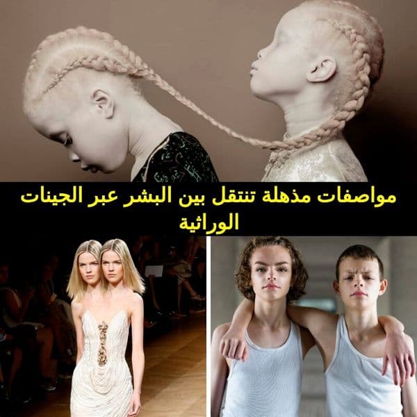 +38 ميزة نادرة الوجود تنتقل عبر الجينات الوراثية