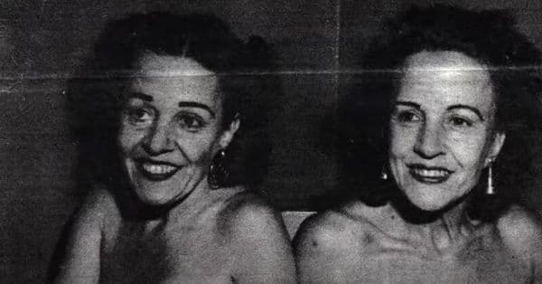 A perturbadora história real de Daisy e Violet Hilton: gêmeas siamesas enfrentam uma luta ao longo da vida.