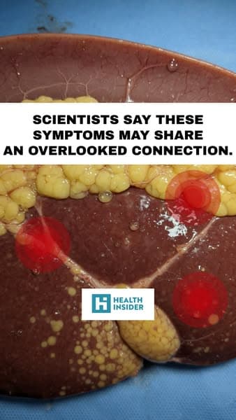 The Overlooked Gut Connection