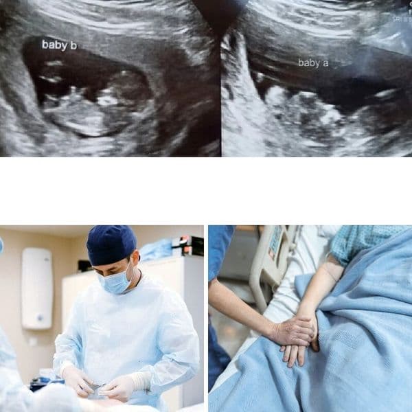 Mamma følte seg syk etter å ha født tvillinger, men så så legen ultralyden hennes.
